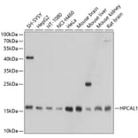 Western Blot - Anti-VILIP3 Antibody (A307365) - Antibodies.com