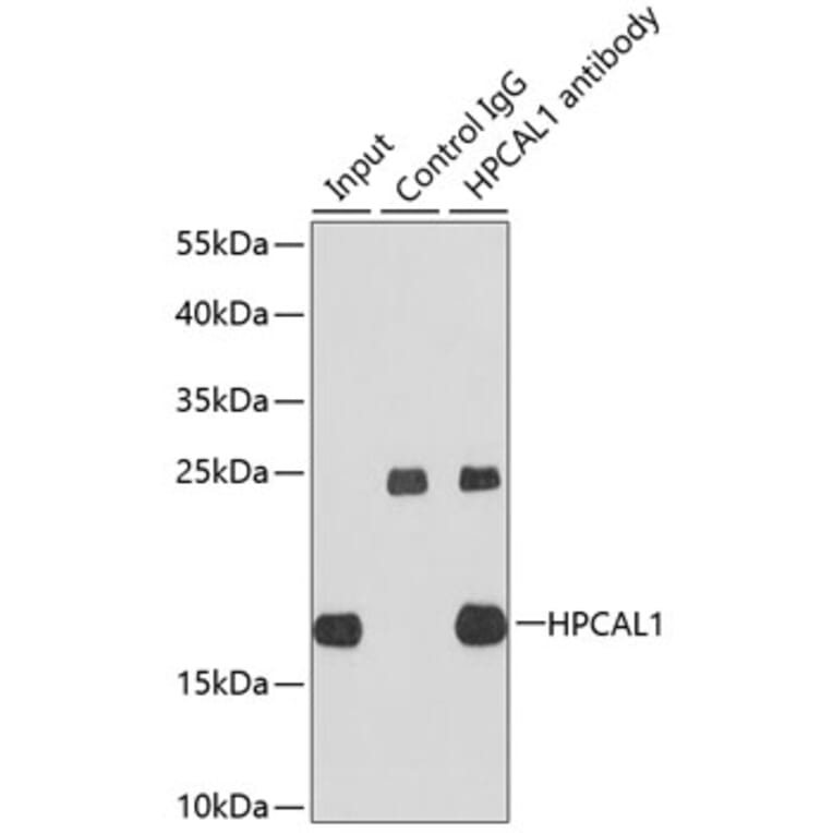 Western Blot - Anti-VILIP3 Antibody (A307365) - Antibodies.com