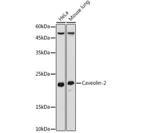 Western Blot - Anti-Caveolin-2 Antibody (A307367) - Antibodies.com