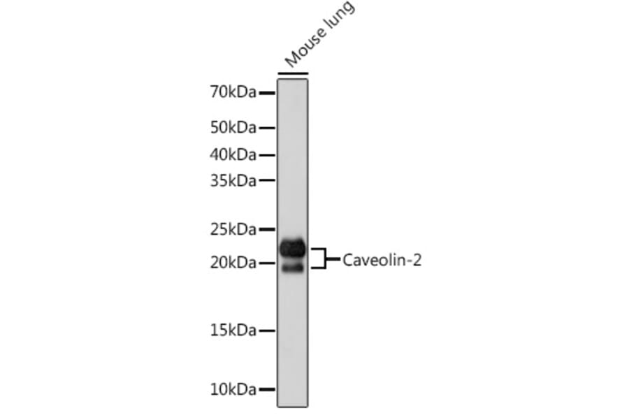 Western Blot - Anti-Caveolin-2 Antibody [ARC0323] (A307368) - Antibodies.com