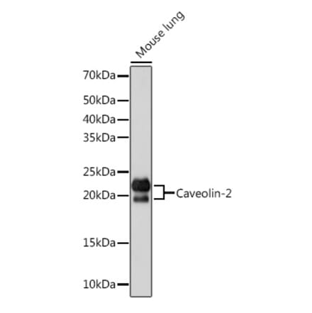 Western Blot - Anti-Caveolin-2 Antibody [ARC0323] (A307368) - Antibodies.com