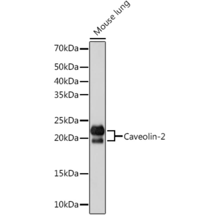 Western Blot - Anti-Caveolin-2 Antibody [ARC0323] (A307368) - Antibodies.com