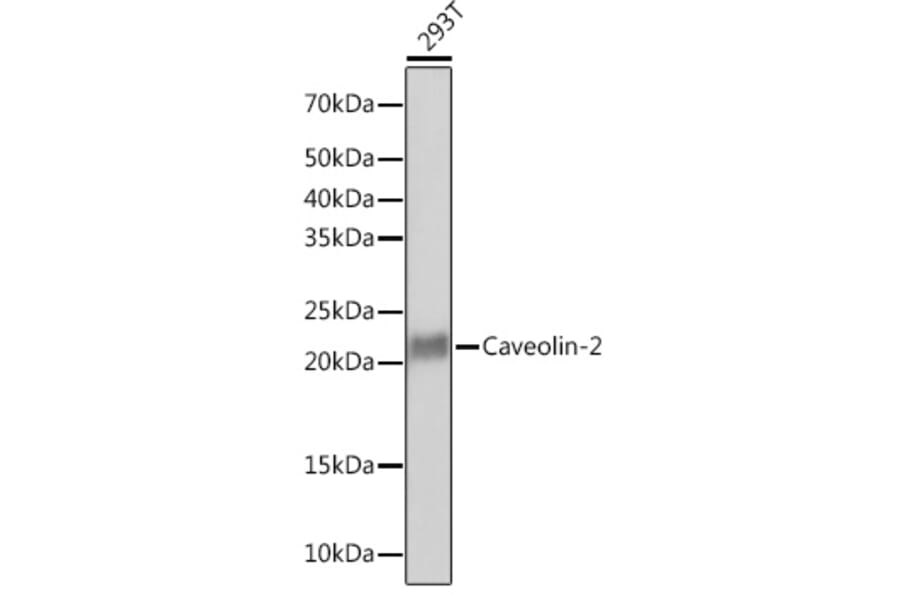 Western Blot - Anti-Caveolin-2 Antibody [ARC0323] (A307368) - Antibodies.com