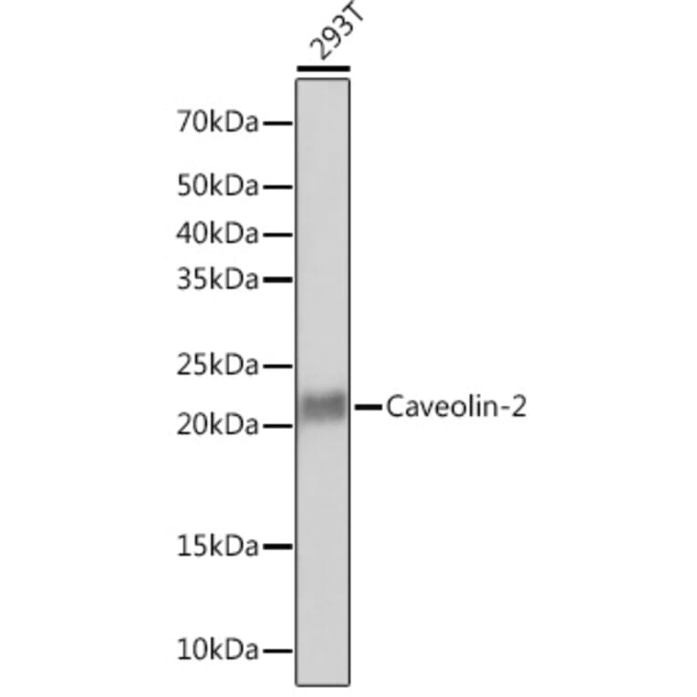 Western Blot - Anti-Caveolin-2 Antibody [ARC0323] (A307368) - Antibodies.com