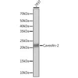 Western Blot - Anti-Caveolin-2 Antibody [ARC0323] (A307368) - Antibodies.com