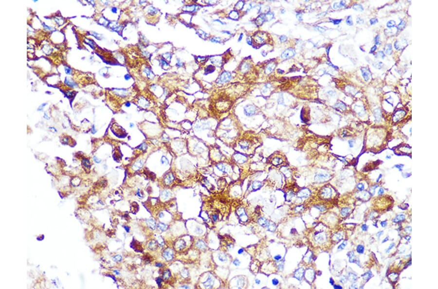 Immunohistochemistry - Anti-Caveolin-2 Antibody [ARC0323] (A307368) - Antibodies.com