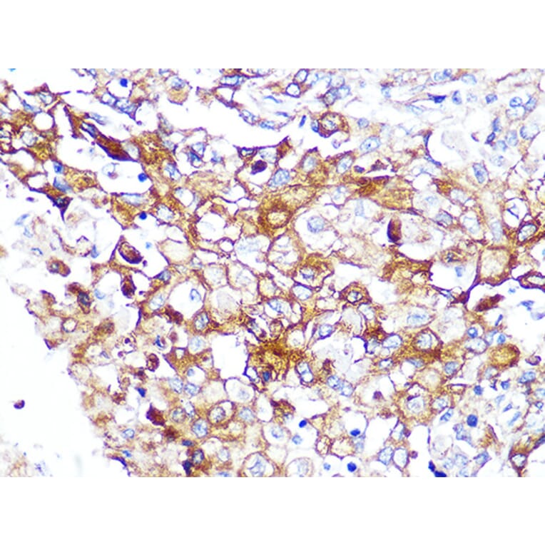 Immunohistochemistry - Anti-Caveolin-2 Antibody [ARC0323] (A307368) - Antibodies.com