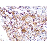 Immunohistochemistry - Anti-Caveolin-2 Antibody [ARC0323] (A307368) - Antibodies.com