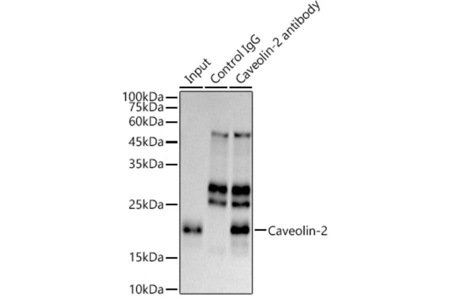 Western Blot - Anti-Caveolin-2 Antibody [ARC0323] (A307368) - Antibodies.com