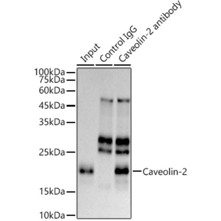 Western Blot - Anti-Caveolin-2 Antibody [ARC0323] (A307368) - Antibodies.com