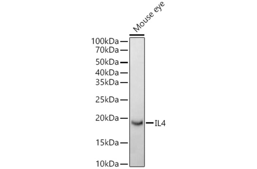 Western Blot - Anti-IL-4 Antibody (A307370) - Antibodies.com