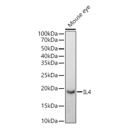 Western Blot - Anti-IL-4 Antibody (A307370) - Antibodies.com