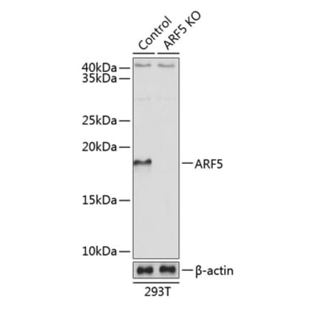 Western Blot - Anti-ARF5 Antibody (A307371) - Antibodies.com