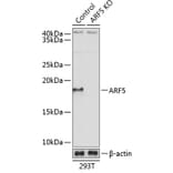 Western Blot - Anti-ARF5 Antibody (A307371) - Antibodies.com