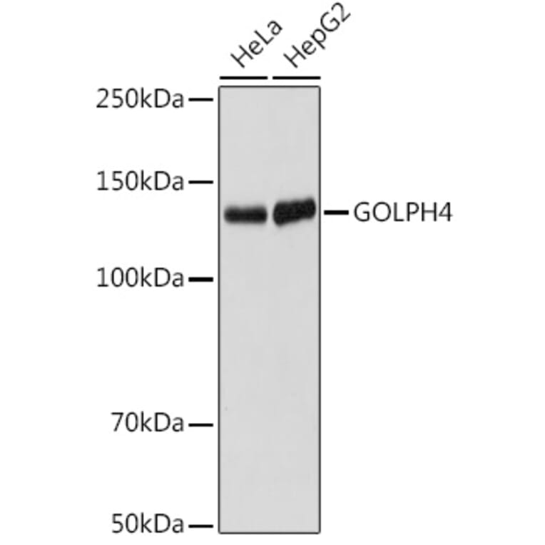 Western Blot - Anti-GOLPH4/GPP130 Antibody [ARC2315] (A307372) - Antibodies.com