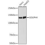 Western Blot - Anti-GOLPH4/GPP130 Antibody [ARC2315] (A307372) - Antibodies.com