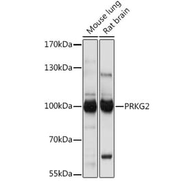 Western Blot - Anti-cGKII Antibody (A307373) - Antibodies.com