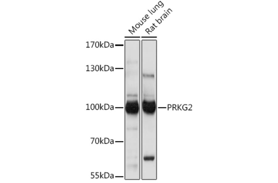 Western Blot - Anti-cGKII Antibody (A307373) - Antibodies.com