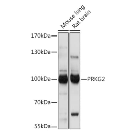 Western Blot - Anti-cGKII Antibody (A307373) - Antibodies.com