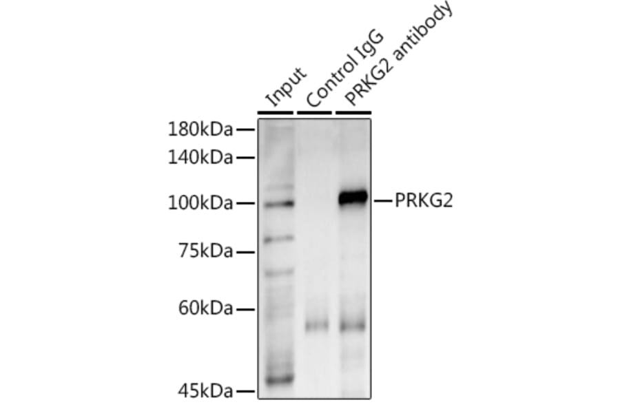 Western Blot - Anti-cGKII Antibody (A307373) - Antibodies.com