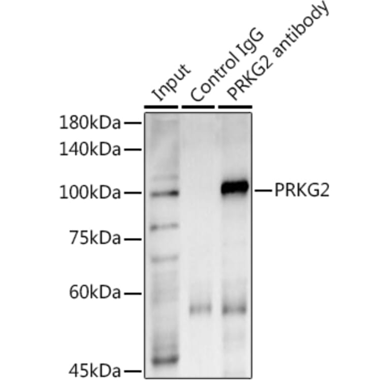 Western Blot - Anti-cGKII Antibody (A307373) - Antibodies.com