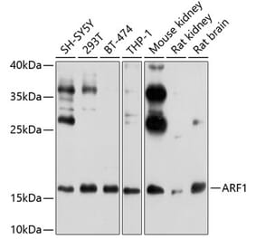 Western Blot - Anti-ARF1 Antibody (A307374) - Antibodies.com