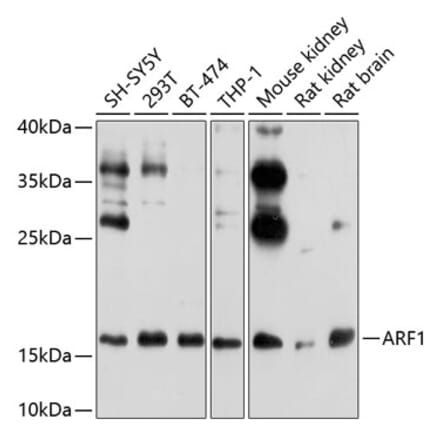 Western Blot - Anti-ARF1 Antibody (A307374) - Antibodies.com