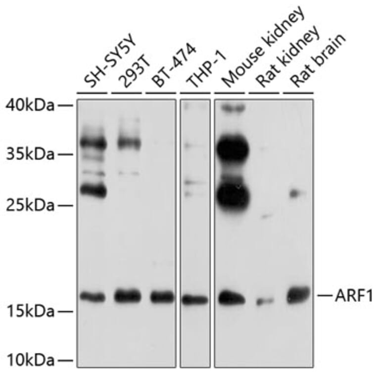 Western Blot - Anti-ARF1 Antibody (A307374) - Antibodies.com