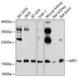 Western Blot - Anti-ARF1 Antibody (A307374) - Antibodies.com