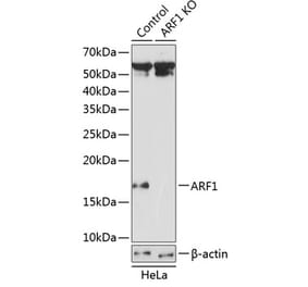 Western Blot - Anti-ARF1 Antibody (A307375) - Antibodies.com