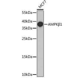 Western Blot - Anti-AMPK beta 1 Antibody (A307377) - Antibodies.com