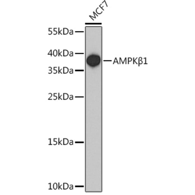 Western Blot - Anti-AMPK beta 1 Antibody (A307377) - Antibodies.com