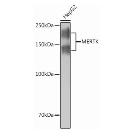 Western Blot - Anti-MERTK Antibody [ARC0229] (A307378) - Antibodies.com