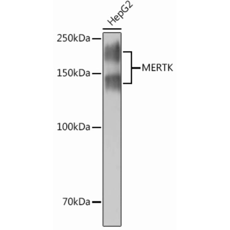 Western Blot - Anti-MERTK Antibody [ARC0229] (A307378) - Antibodies.com