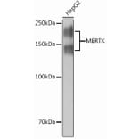 Western Blot - Anti-MERTK Antibody [ARC0229] (A307378) - Antibodies.com