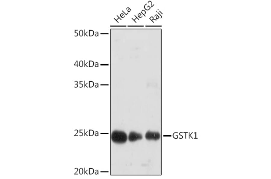 Western Blot - Anti-GSTK1 Antibody [ARC1689] (A307379) - Antibodies.com