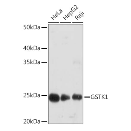 Western Blot - Anti-GSTK1 Antibody [ARC1689] (A307379) - Antibodies.com