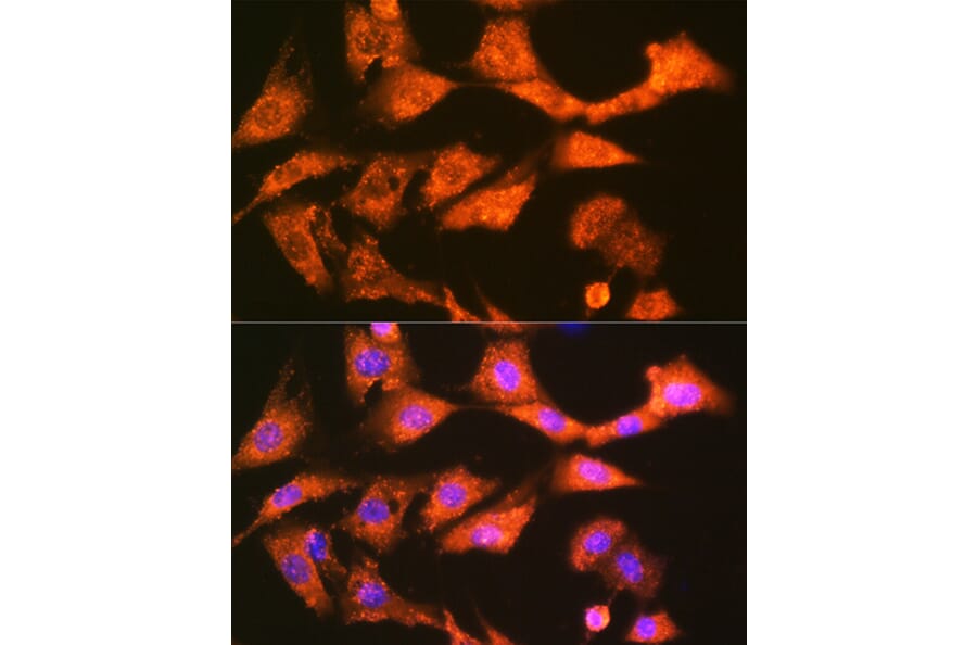 Immunofluorescence - Anti-GSTK1 Antibody [ARC1689] (A307379) - Antibodies.com
