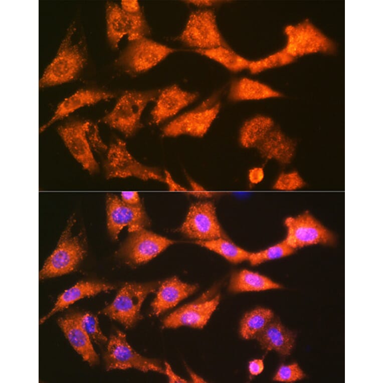 Immunofluorescence - Anti-GSTK1 Antibody [ARC1689] (A307379) - Antibodies.com