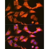 Immunofluorescence - Anti-GSTK1 Antibody [ARC1689] (A307379) - Antibodies.com