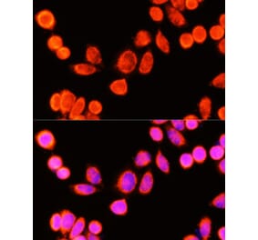 Immunofluorescence - Anti-GSTK1 Antibody (A307380) - Antibodies.com