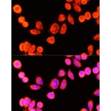 Immunofluorescence - Anti-GSTK1 Antibody (A307380) - Antibodies.com