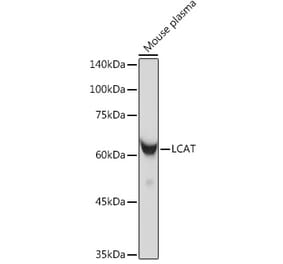 Western Blot - Anti-LCAT Antibody [ARC2383] (A307382) - Antibodies.com