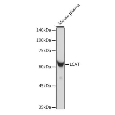 Western Blot - Anti-LCAT Antibody [ARC2383] (A307382) - Antibodies.com