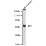 Western Blot - Anti-LCAT Antibody [ARC2383] (A307382) - Antibodies.com