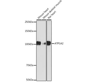 Western Blot - Anti-ATP1A2 Antibody [ARC2458] (A307386) - Antibodies.com