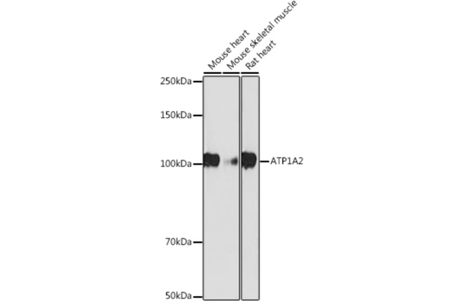 Western Blot - Anti-ATP1A2 Antibody [ARC2458] (A307386) - Antibodies.com