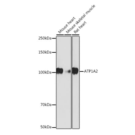 Western Blot - Anti-ATP1A2 Antibody [ARC2458] (A307386) - Antibodies.com