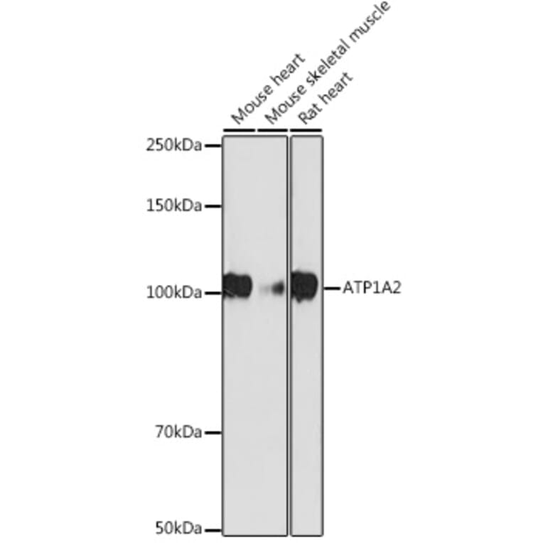 Western Blot - Anti-ATP1A2 Antibody [ARC2458] (A307386) - Antibodies.com