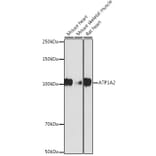 Western Blot - Anti-ATP1A2 Antibody [ARC2458] (A307386) - Antibodies.com